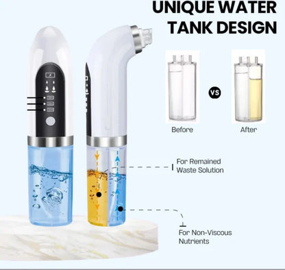 Bubble Facial &amp; Blackhead Remover